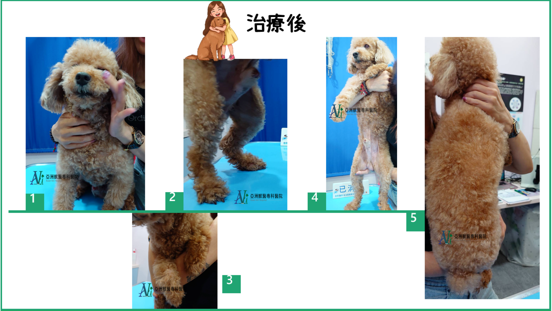 異位性皮膚炎-治療後