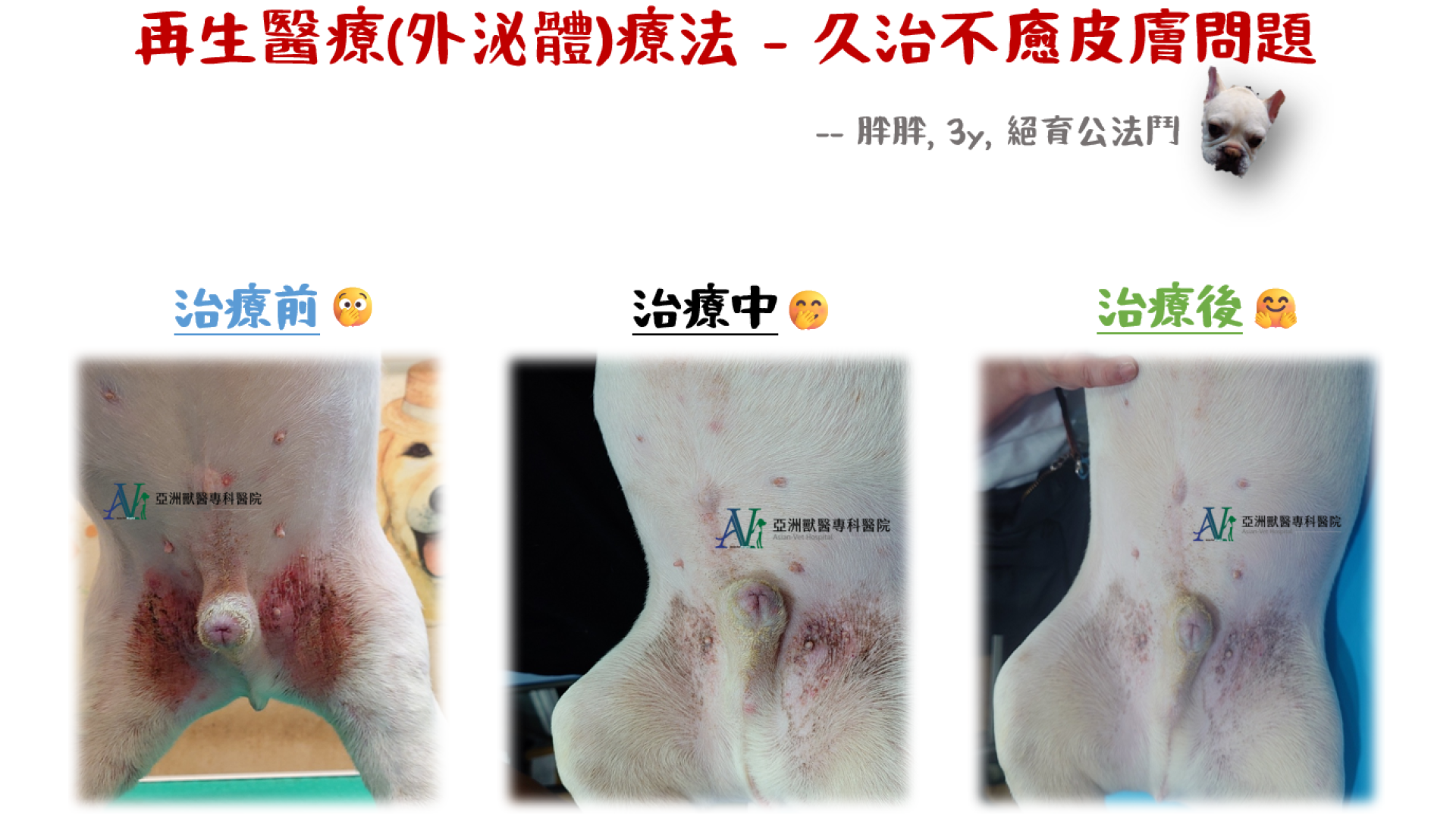 再生醫學-外泌體療法